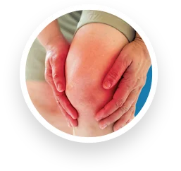 Knie